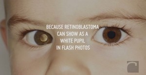 retinoblasti